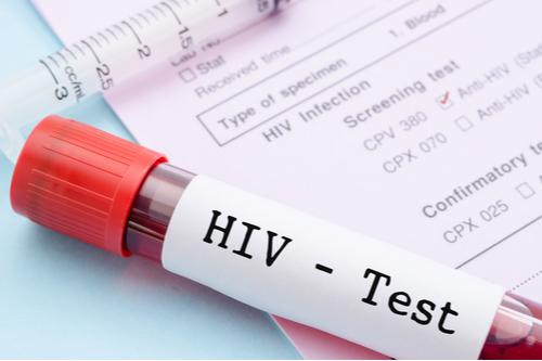 prueba de VIH
