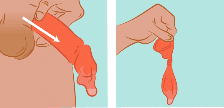 como quitarse un condón
