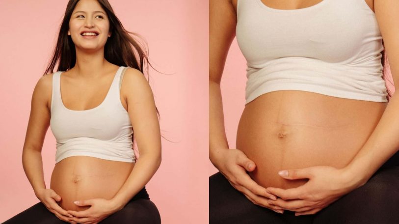 9 efectos secundarios comunes del embarazo